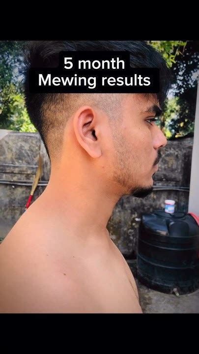 mewing results|mike mew.